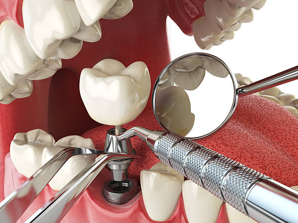 Best Emergency TMJ Treatment in Mayville, ND